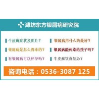 濰坊看銀屑病專業(yè)的方法